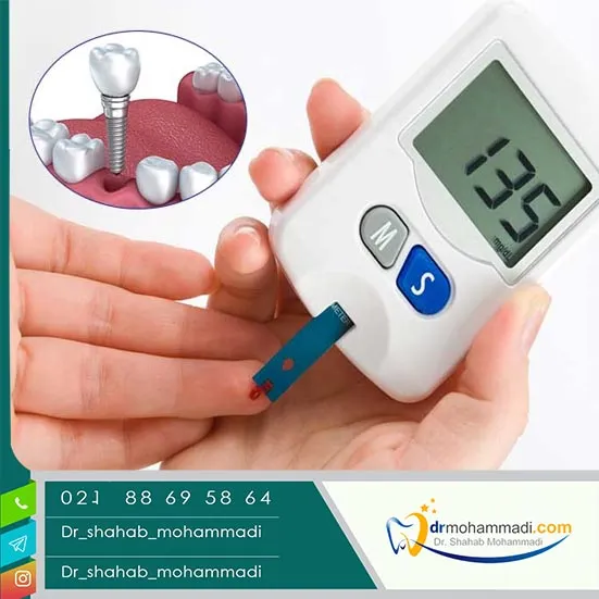 ایمپلنت برای افراد دیابتی: آیا ممکن است؟